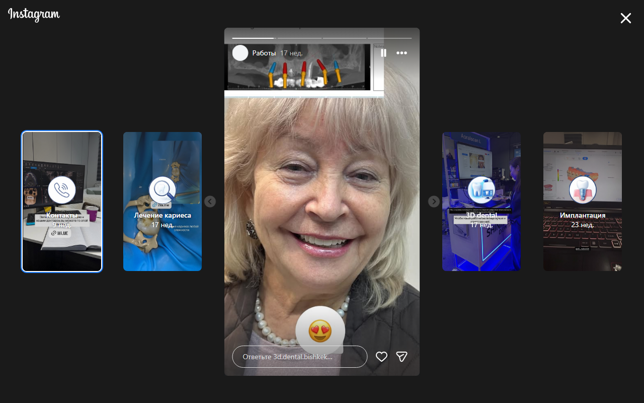 Результат протезирования — до и после