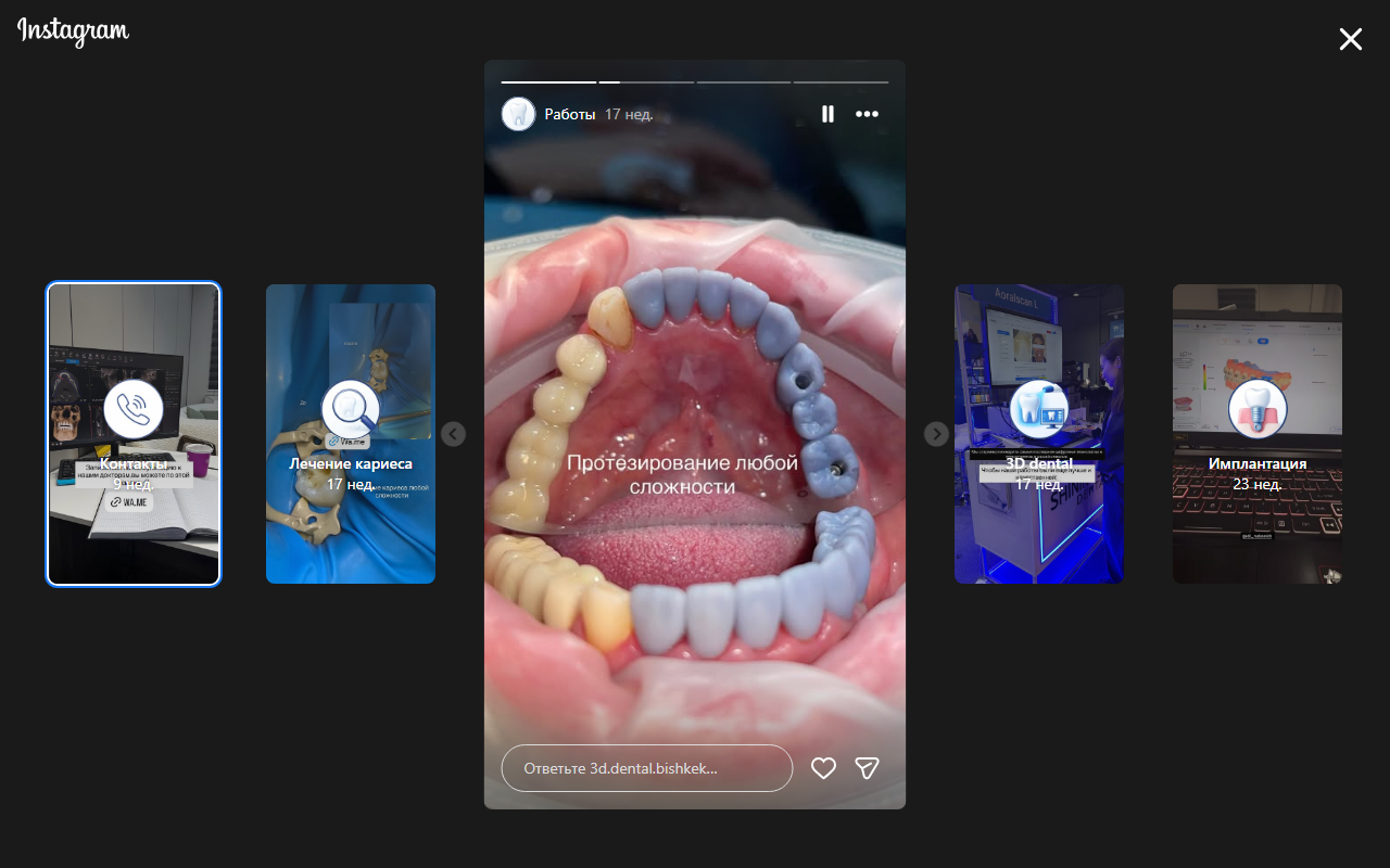 Циркониевые коронки протезирование