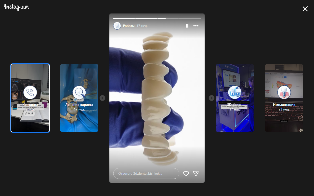 Ортодонтия брекеты элайнеры