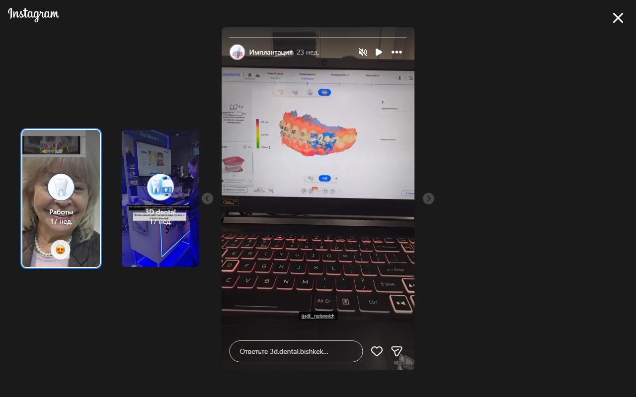 3D диагностика и имплантация All-on-4