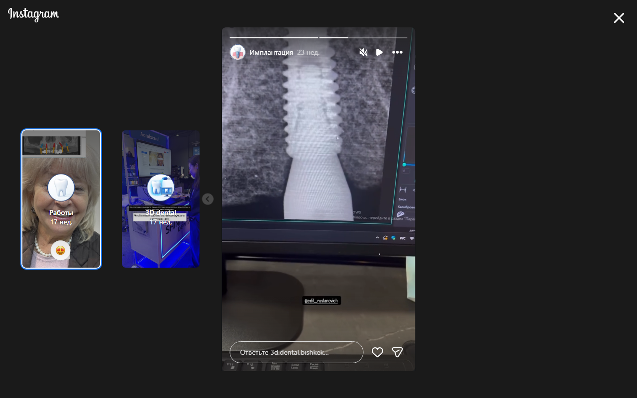 Цветовая карта 3D диагностики зубов