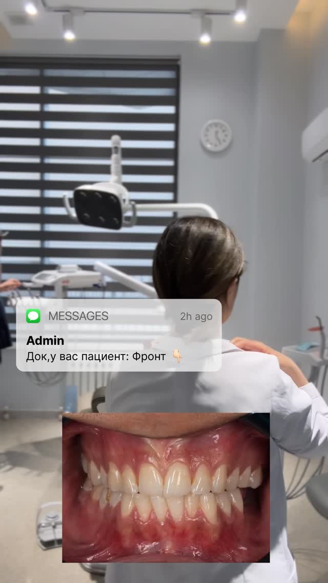 Реставрация фронтальной группы зубов