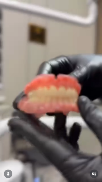 Съёмное протезирование Candulor