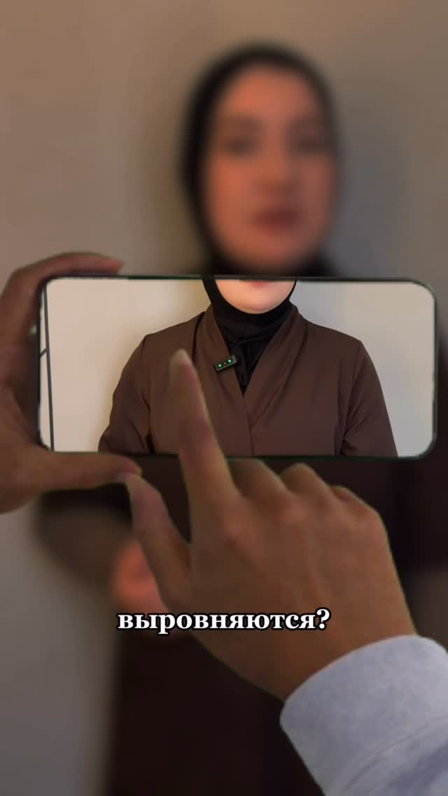 Ортодонтия для детей