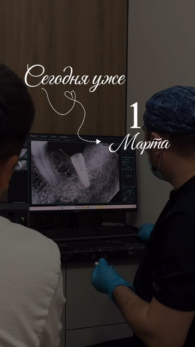 Имплантация